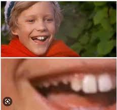 Charlie Buckets teeth : r/oddlyterrifying