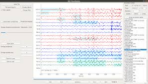 Confession letter from former cop claims link between nypd, fbi and malcolm x killing. Software Links Neural Systems Analysis Laboratoryneural Systems Analysis Laboratory