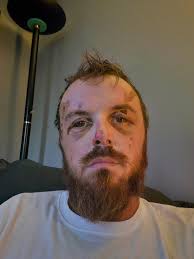 My uncle was sadly involved in a freak motorcycle accident, Any and  everything helps and is appreciated. 🙏🏻🥹