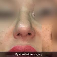 R LAURENCE BERKOWITZ, MD