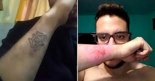 We would like to show you a description here but the site won't allow us. Argentino Usa Ralador De Queijo Para Remover Tatuagem Uma Semana Depois De Faze La O Livre