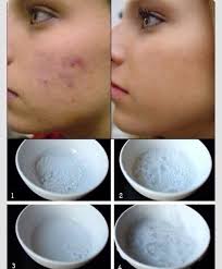 Dalam dunia kue, hampir semua jenis roti, kue. Bukan Hanya Untuk Cake Ini 4 Kegunaan Baking Soda Untuk Kecantikan