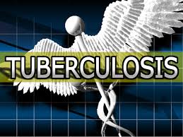 When tb occurs outside your lungs, signs and symptoms vary according to the organs involved. 9 Sample Of Pulmonary Tuberculosis Ptb Nursing Diagnosis Nanda Ananda Notes
