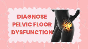 Image result for Pelvic Floor Dysfunction
