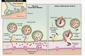 The effect of botulinum toxin may affect areas away from the injection site and cause serious symptoms including: Botulinum Toxin Protein Molecule