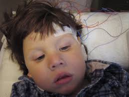 calvin's story: October 2015