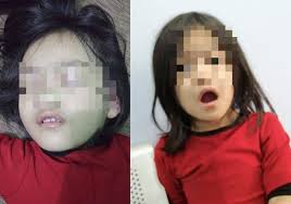 Adat resam dan kebudayaan jilid 1 1990. Ibu Panik Anak 4 Tahun Meraung Mulut Ternganga Air Liur Meleleh Rupa Rupanya Gigit Sesuatu Di Luar Rumah Doktor Tanya Telan Ke Nashwa Tak Boleh Cakap Viral Mstar