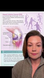 How to Say Osgood Schlatter Syndrome