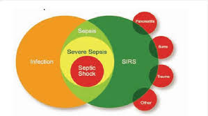Evaluation and management of suspected sepsis and septic shock in adults. Relationship Of Sirs Sepsis Severe Sepsis And Septic Shock Need Download Scientific Diagram