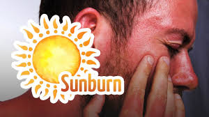 Serum ni sesuai untuk semua jenis kulit terutamanya yang ada kulit sensitif dan berminyak serta yang ada kesan sunburn. 7 Petua Mudah Hilangkan Sunburn Di Wajah Dengan Bahan Mudah