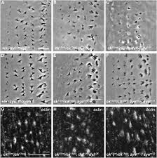 Price war is the root of many evils: Mutations In Drosophila Crinkled Myosin Viia Disrupt Denticle Morphogenesis Sciencedirect