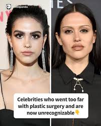 Celebrities who went too far with plastic surgery and are now  unrecognizable (link in the comments)