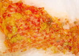 Perhatikan najis berwarna putih, kelabu, atau terang. Baby Poop A Visual Guide Babycenter