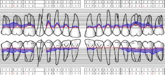 maxilar periodontal chart figure 5 mandibular periodontal