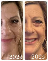 What are the benefits of using Rodan + Fields Radiant Defense Perfecting  Liquid?