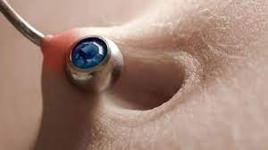 Infected Belly Button Piercing Cleaning Tips More Infected Belly Button Belly Button Piercing Cleaning Belly Button Piercing