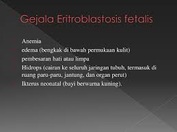 We did not find results for: Kelainan Dan Penyakit Pada Sistem Transportasi Darah Ppt Download