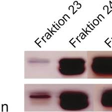 Jadi sst ditanggung oleh mereka yang mewah dan golongan pertengahan jika mereka membeli. Pdf Der Coxsackie Und Adenovirus Rezeptor Im Embryonalen Nervensystem Ein Homophiles Und Heterophiles Zelladhasionsmolekul