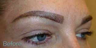 We all know that tattoos are essentially permanent, with tattoo removal being quite painful and expensive even today. Juvessentials Is 1 Rated For Cosmetic Tattooing And Correction In The San Francisco Bay Area 490 Post St 647 San Francisco Ca 94102 415 654 5859