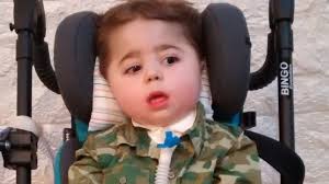 Tipo i (omim # 253300), tipo ii. Santi Tiene Dos Anos Y Tiene Una Enfermedad Mortal Que Avanza Velozmente Pero Su Obra Social Se Niega A Pagarle El Tratamiento Red De Informacion