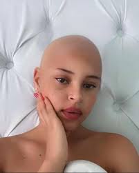 SURPRISE SURPRISE😂😂😂 Mrs Chanda Brian (Jasmine)