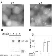 Generation 1 and generation 2. In Vivo Analysis Of Autophagy In Response To Nutrient Starvation Using Transgenic Mice Expressing A Fluorescent Autophagosome Marker Molecular Biology Of The Cell