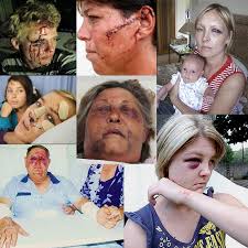 Résultat de recherche d'images pour "south african white genocide rape"