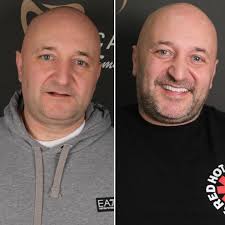 Assoc Prof Dr Ayça Tulga, DDS, PhD (@draycatulga) · Instagram 照片和视频