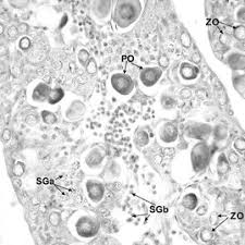Transverse section of a mosaic type intersex gonad of Mugil curema...