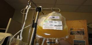 Image result for Platelet Transfusion