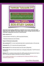 Ecg Ventricular Tachycardia Nursing School Survival Nursing Information Cardiology Nursing