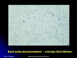 We did not find results for: Spitalul Clinic De Urgenta Sf Ioan Bucuresti Ppt Katebasma