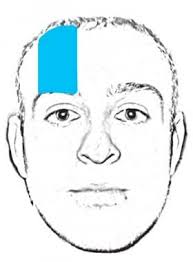 Image result for Forehead Regional Block