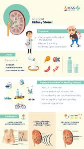 All About Kidney Stones Infographic Max Hospital