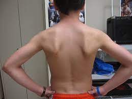 I figured i could wash it off with water and walk it off. If Your Shoulders Look Like This You Need To Do Something About It Andrew Sacks Sports Performance