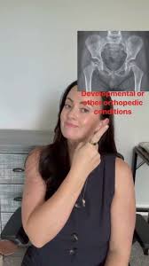 Image result for Pediatric Limp