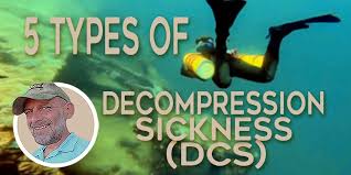 Image result for Decompression Sickness