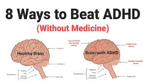 Fda approves adhd drug for maintenance treatment in kids. 8 Ways To Beat Adhd Without Medicine