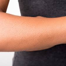 With early diagnosis and advanced treatment methods. Pasien Kanker Limfoma Non Hodgkin Bisa Sembuh Asal Health Liputan6 Com