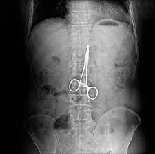Pin On X Ray Baby Xray