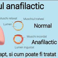 Afla si tu, in cele ce urmeaza, ce cauze poate avea senzatia de nod in gat si ce tratament se poate folosi pentru a o inlatura! Senzatie De Nod In Gat
