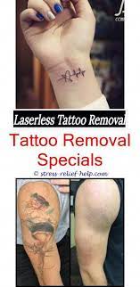 Surgical Tattoo Removal Before And After Can U Get Laser Hair Removal Over Tattoos How To Remove Transf Tattoo Removal Tattoo Removal Cost Tattoo Removal Cream