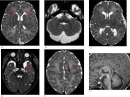 Image result for Incidental Imaging Finding