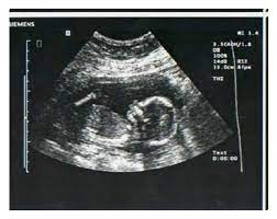 Designer Clothes Shoes Bags For Women Ssense Ultrasound Getting Pregnant Fake Ultrasound