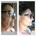 Hoang Bui, MD, Board Certified Plastic Surgeon