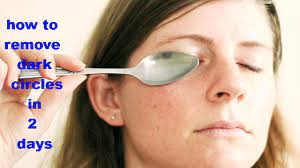 What is the quickest way to get rid of dark circles? How To Remove Dark Circles In 2 Days With Naturally How To Remove Dark Circles In 2 Days Youtube