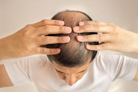 17 hacks for getting longer, thicker hair fast. Human Growth Hormone Hgh For Prevent Hair Loss And Regrowth