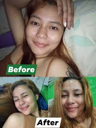 Sabi ni customer Yang Acma, “Two days pa lang, may pa-glow na agad si face!  Shine bright like a diamond, besh!” 💎🌞 Kaya kung ikaw, todo tipid sa  skincare—hala, girl… wag ganern!