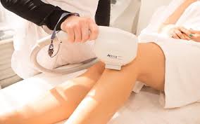 The most common areas for hair removal include Alma Laser Hair Removal Available At Cameo Spa And Laser Clinic Laser Hair Removal Hair Removal Systems Hair Removal