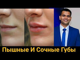 как отбелить лицо в домашних условиях за 1 день Pyshnye I Sochnye Guby Kak Vosstanovit Suhie Guby Doktor Vivek Youtube Suhie Guby Guby Lico